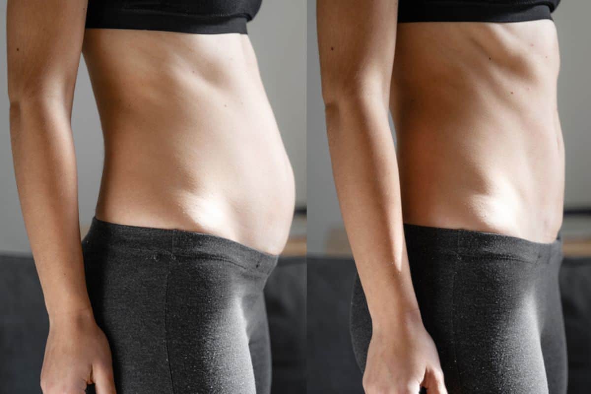 Post-Pregnancy: What Happens to Your Abdominal Muscles After Birth Matlock