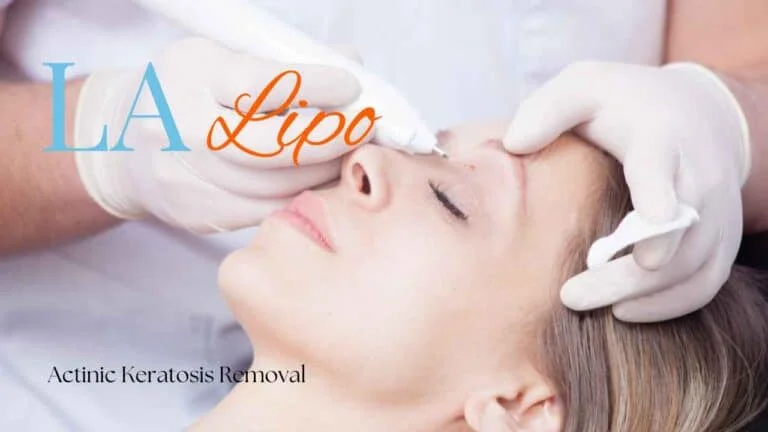 Woman receiving Actinic Keratosis Removal Treatment Matlock