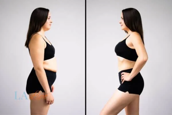link between body image and mental health Matlock