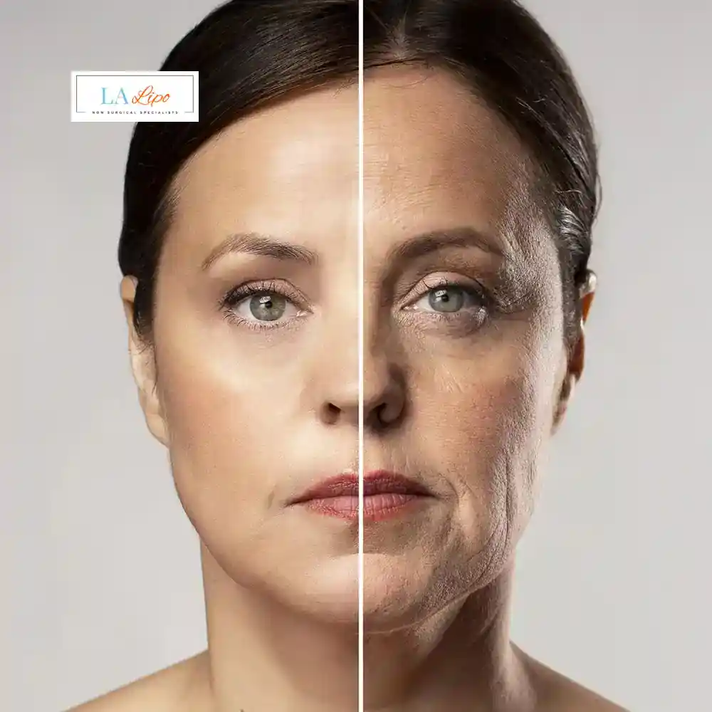 How Can You Tell If Non-Surgical Skin Tightening Is Right for You Matlock?
