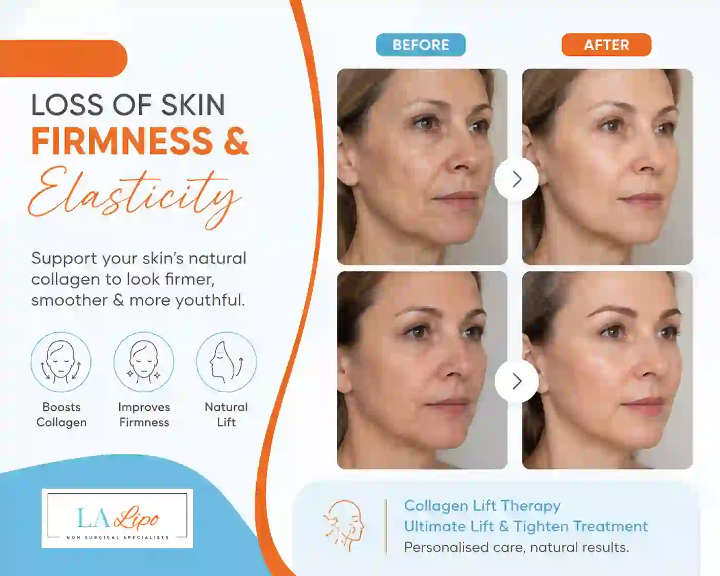 Sign #7: Loss of Skin Firmness and Elasticity Matlock
