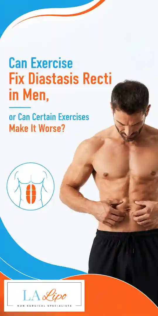 Can Exercise Fix Diastasis Recti in Men, or Can Certain Exercises Make It Worse Matlock?