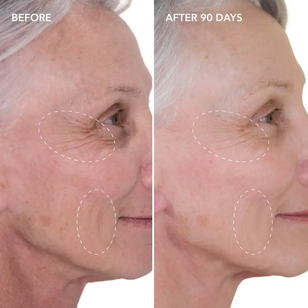 When will you see results Matlock